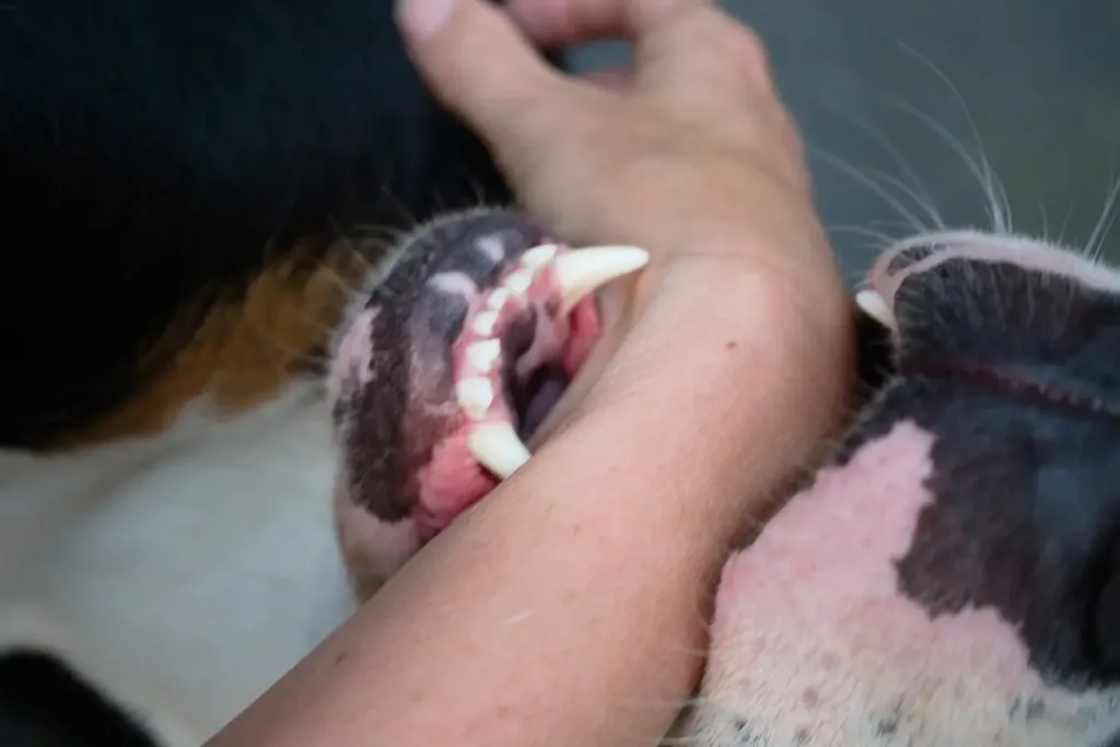 Dog biting person's arm causing the person to need to hire a dog bite lawyer.